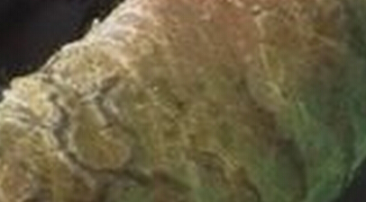 预防牛皮癣需要注意哪些问题